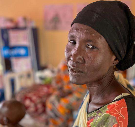 A displaced woman in South Sudan.